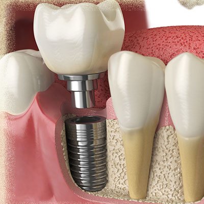 dentista